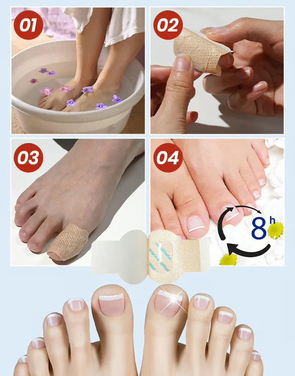 Anti-Mold Nail Patches
