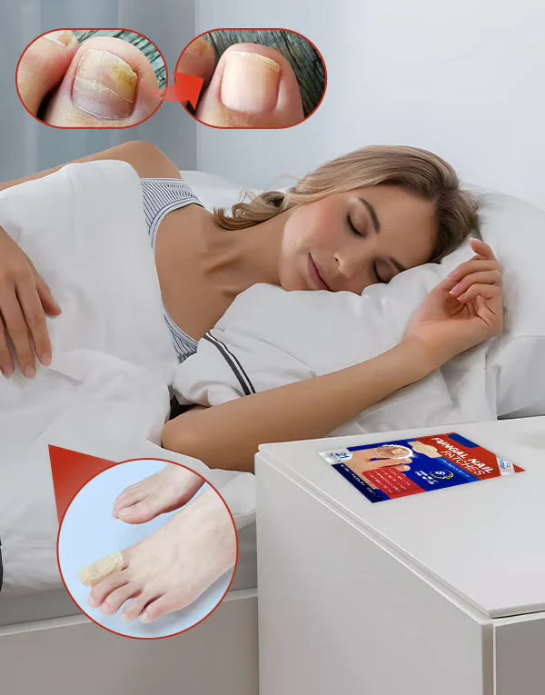Anti-Mold Nail Patches