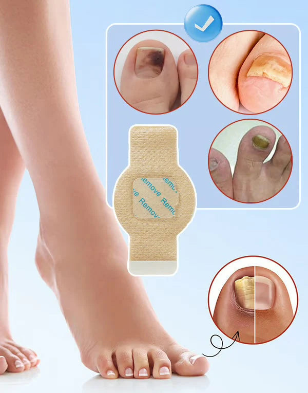 Anti-Mold Nail Patches