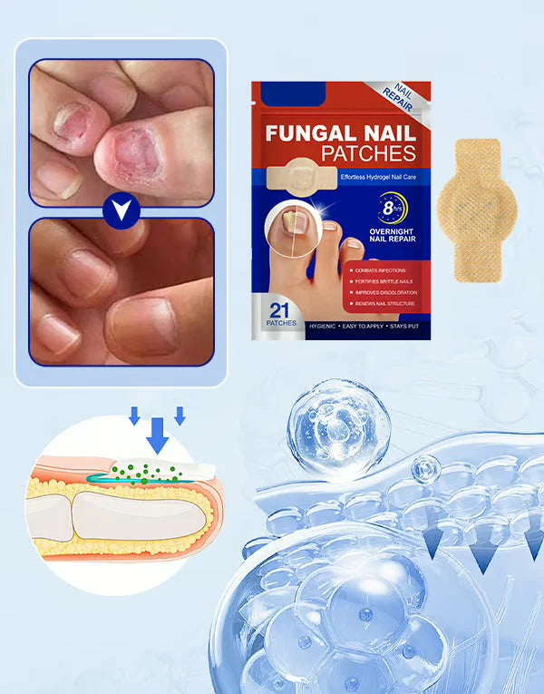 Anti-Mold Nail Patches