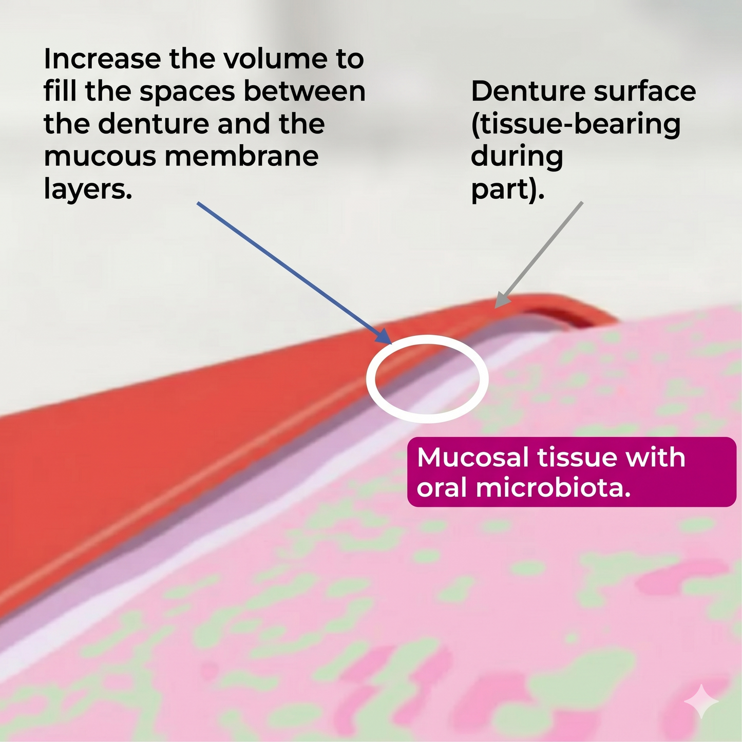 Allday Secure – strong denture adhesive